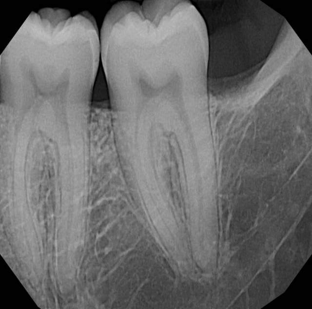 Shitet Grafi dentare Panorameks i vitit 2015, 8.000 €